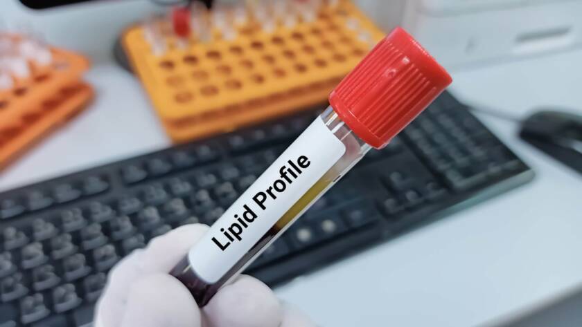 Lipid profile