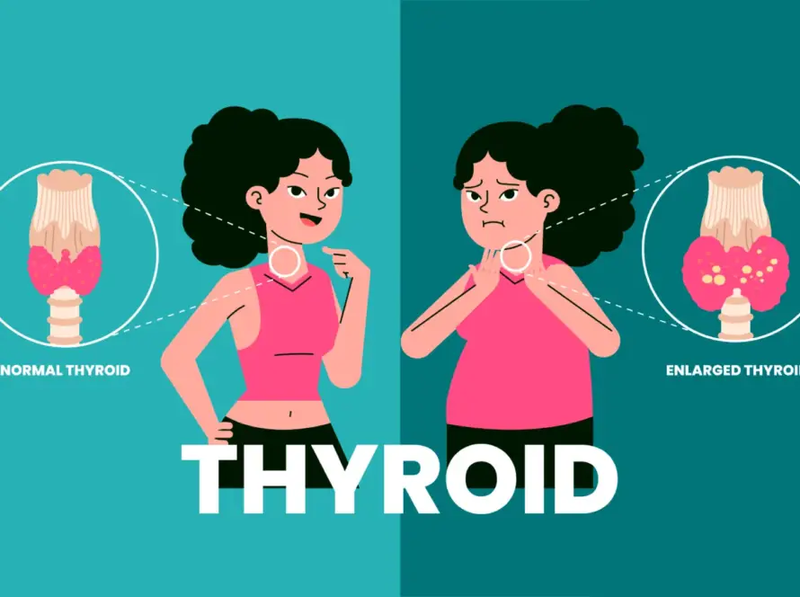 Thyroid Disorder